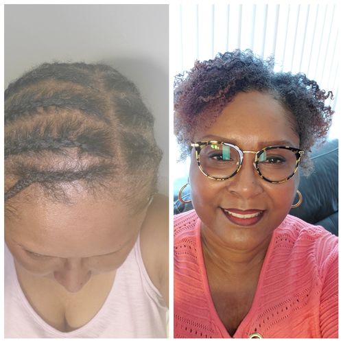 Customer photo review of Flower Bomb Hair Growth Oil