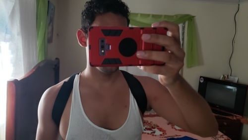 Customer photo review of Adjustable Back Posture Brace Clavicle Support Posture Corrector and Pain Relief