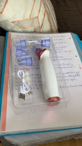 Customer photo review of Electric Blackhead Removal and Facial Pore Suction Vacuum Cleaner