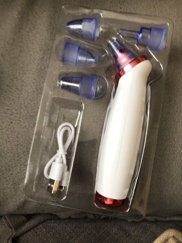 Customer photo review of Electric Blackhead Removal and Facial Pore Suction Vacuum Cleaner