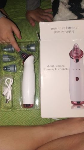 Customer photo review of Electric Blackhead Removal and Facial Pore Suction Vacuum Cleaner