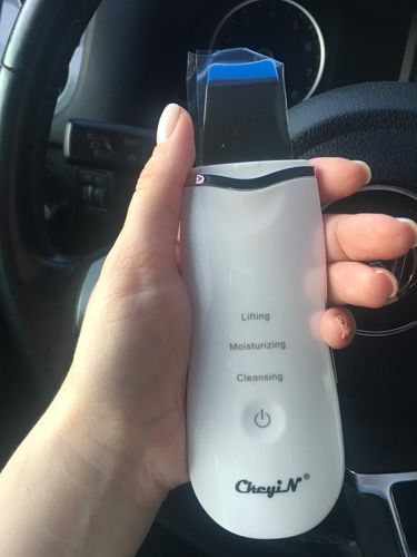Customer photo review of Electric Ultrasonic Facial Skin Scrubber - Ionic Deep Face Cleaning
