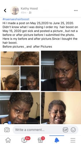 Customer photo review of Nae Nae's 9oz Hair Boost Special