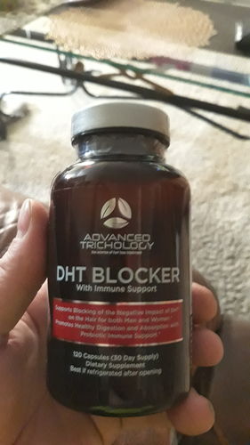 Customer photo review of THANK YOU - DHT Blocker Vitamin with Immune Support, Saw Palmetto, and Green Tea