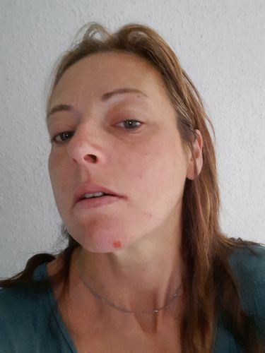 Customer photo review of Cleoglam Enzyme Peeling Maske 29g -   7 Wochen Kur