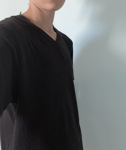 Customer photo review of ACTIVE (non-bandage)