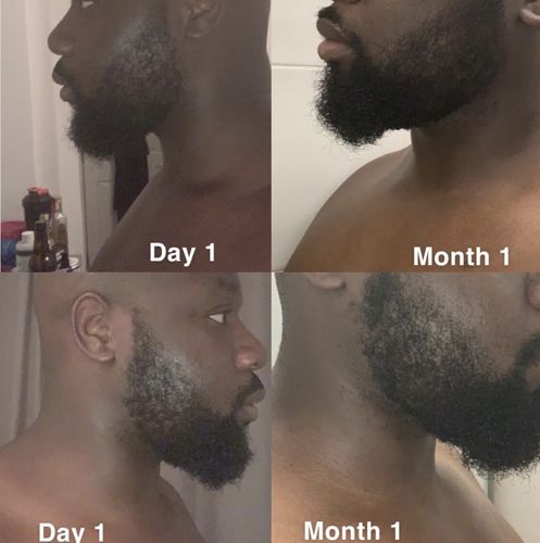 Customer photo review of Inches - Ayurvedic Hair & Beard Growth Oil