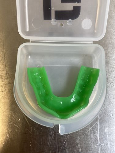 Customer photo review of APEX™ Lite- Green