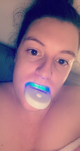 Customer photo review of Refill Kit