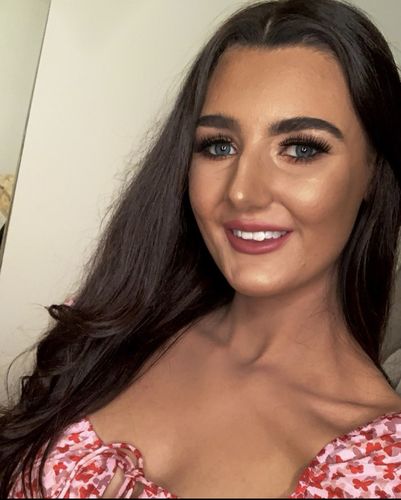 Customer photo review of Teeth Whitening Pen