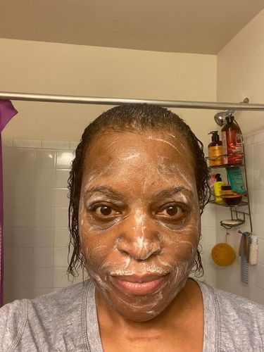 Customer photo review of 3 Pack Turmeric Soap