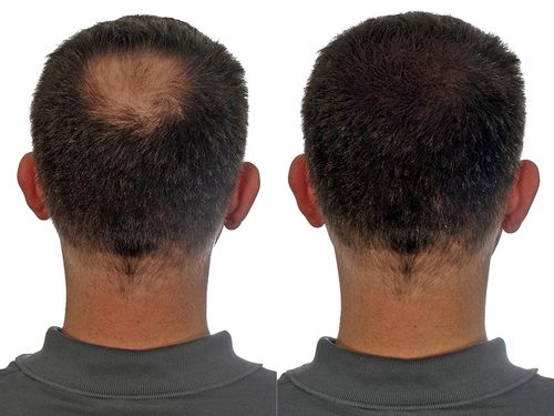 Customer photo review of KIT HAIR VIKING