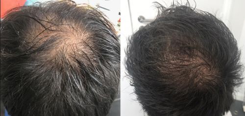 Customer photo review of KIT HAIR VIKING