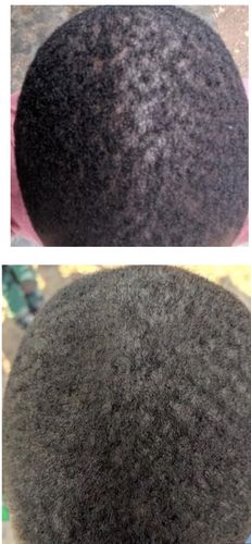 Customer photo review of India’s  Secret Herbal Hair Growth Stimulator (1.69oz) Grow at least 1 inch a month