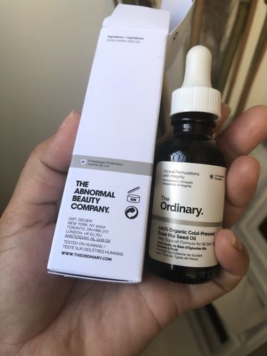 Customer photo review of Niacinamide 10% + Zinc 1%