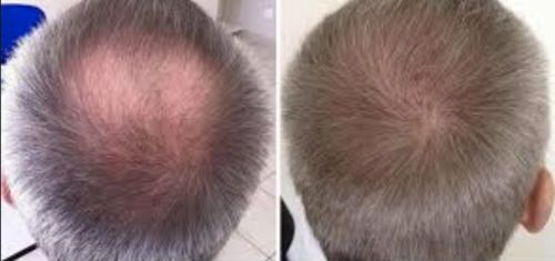 Customer photo review of KIT HAIR VIKING