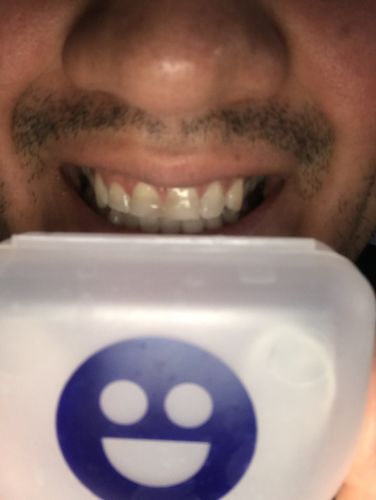 Customer photo review of Night Guard