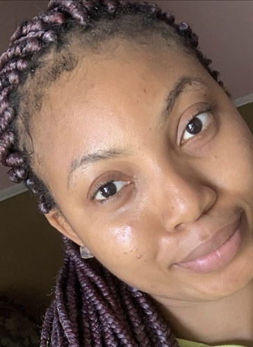 Customer photo review of India’s  Secret Herbal Hair Growth Stimulator (1.69oz) Grow at least 1 inch a month