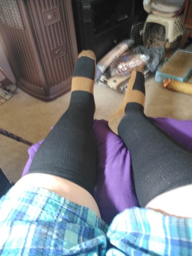 Customer photo review of Copper Compression Socks (3-Pack)