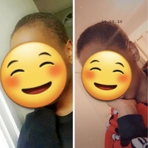 Customer photo review of Inches - Ayurvedic Hair & Beard Growth Oil