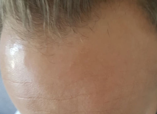 Customer photo review of India’s  Secret Herbal Hair Growth Stimulator (1.69oz) Grow at least 1 inch a month