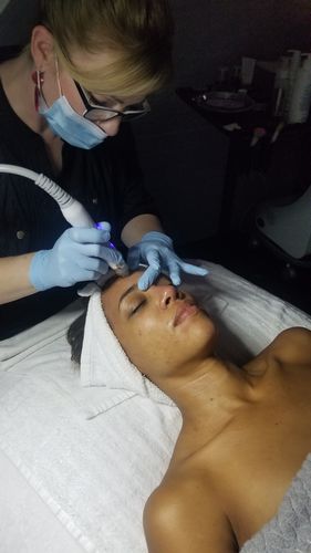 Customer photo review of Exfoliant Formula 500ml/16.9oz