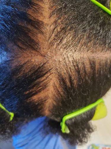 Customer photo review of Nae Nae's 9oz Hair Boost Special