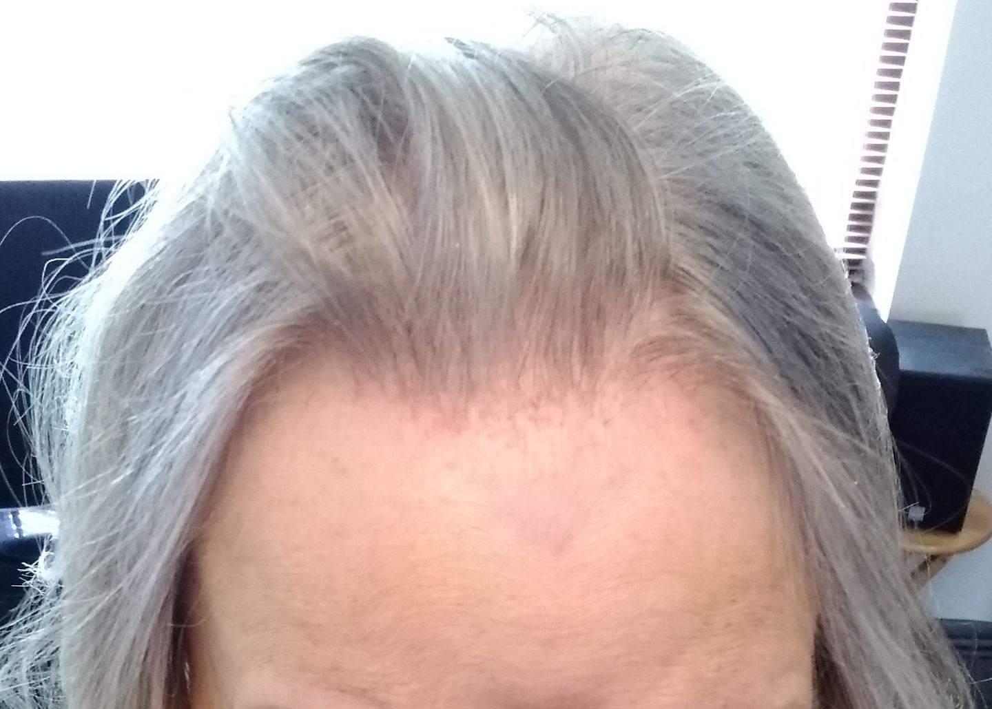 Customer photo review of Scalp Oil