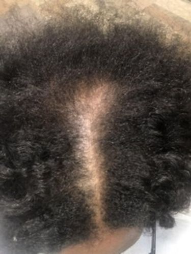 Customer photo review of Nae Nae's Hair Boost 9oz