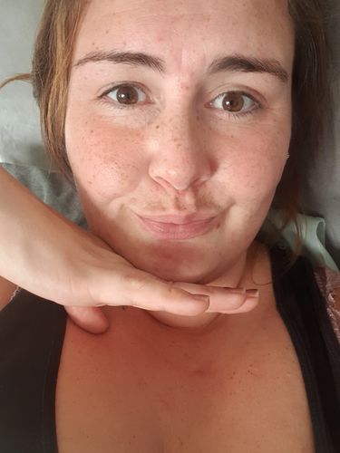 Customer photo review of SkinGlow Electric Cleanser - No More Blackheads