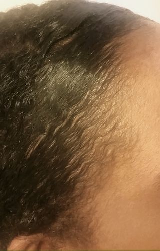 Customer photo review of Chad and India’s Root to Tip Combo. FREE POUF PROTECTOR BONNET INCLUDED