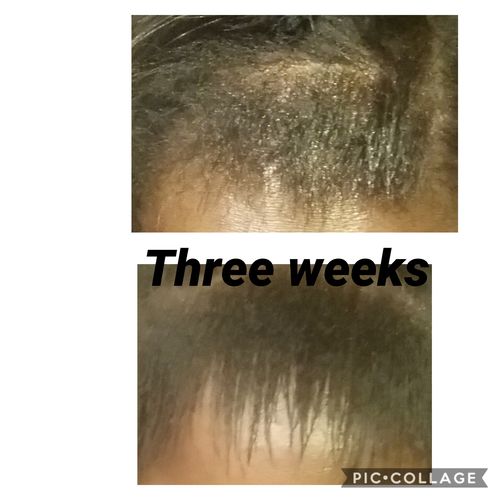 Customer photo review of India’s  Secret Herbal Hair Growth Stimulator (1.69oz) Grow at least 1 inch a month