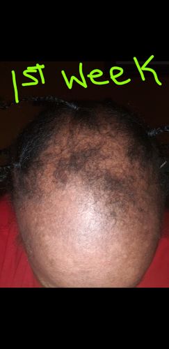 Customer photo review of Nae Nae's Hair Boost 9oz