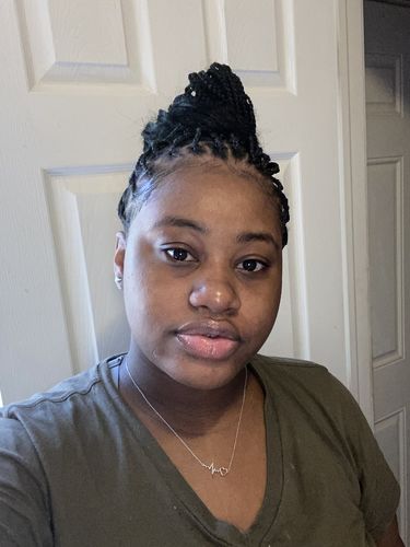 Customer photo review of The 4 Piece Treatment System