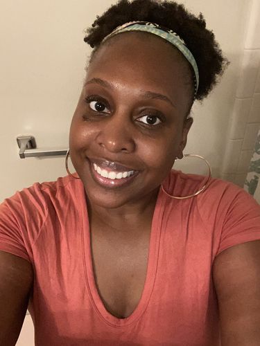 Customer photo review of Flower Bomb Hair Growth Oil