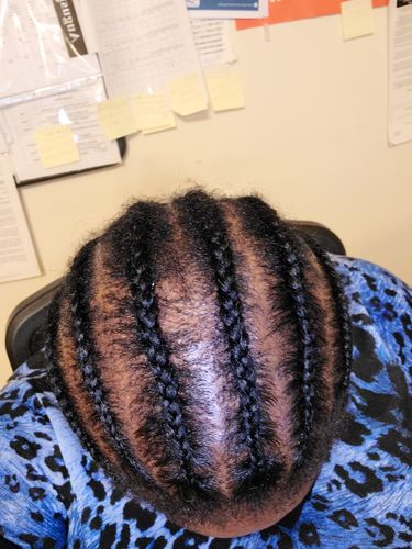 Customer photo review of PureFix Hair Elixir