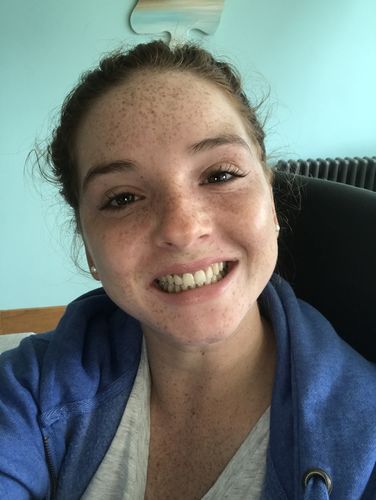 Customer photo review of Black Edition – Charcoal Tooth Polish