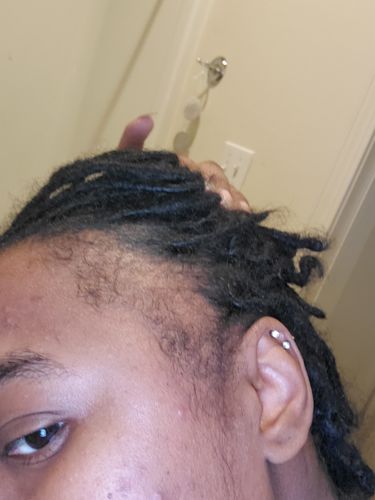 Customer photo review of PureFix Hair Elixir