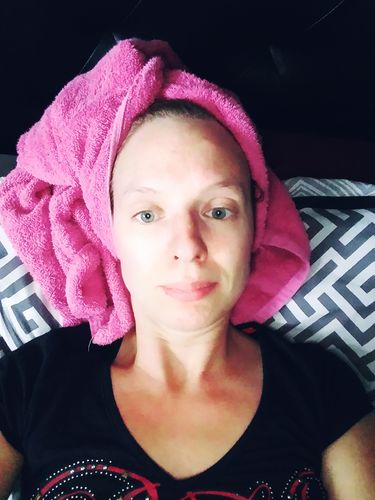 Customer photo review of ODERMIUM SKIN ACTIVE™Soin anti-âge professionnel
