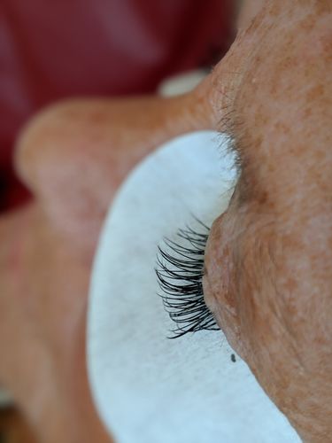 Customer photo review of Anti-wrinkle Collagen Lint Free Pads1