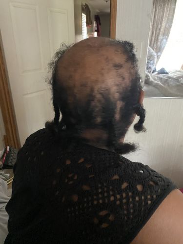 Customer photo review of PureFix Hair Elixir