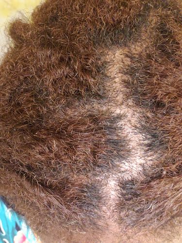 Customer photo review of Peculiar Locs Conditioner Bar (New)