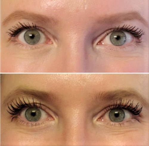 Customer photo review of SHOW LASH