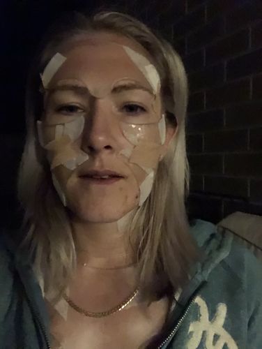 Customer photo review of Anti-Wrinkle Patches (All-in-one)