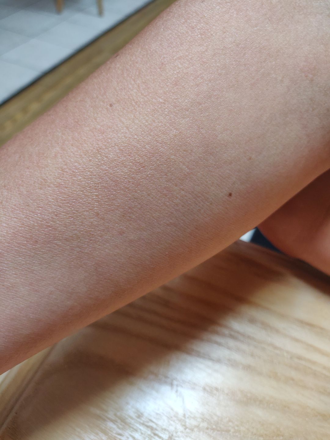 Customer photo review of Soothing Spray