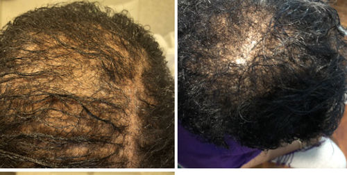 Customer photo review of PureFix Hair Elixir