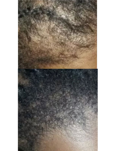 Customer photo review of Chad and India’s Root to Tip Combo. FREE POUF PROTECTOR BONNET INCLUDED