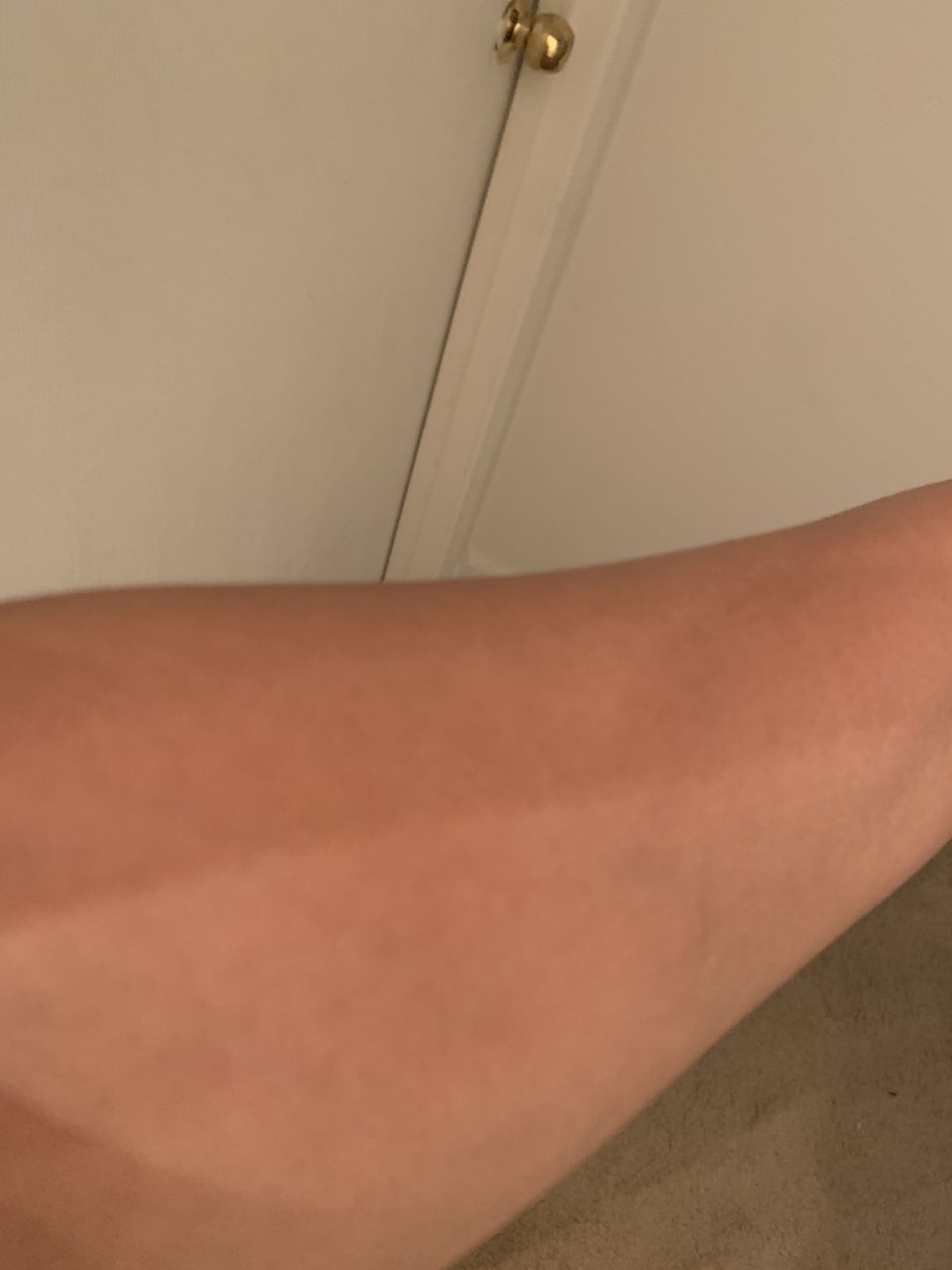 Customer photo review of Fair And White 2: Gold Revitalizing Fade Cream 50ml / 1.7fl.oz