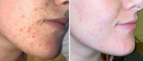 Customer photo review of Wie bekomme ich reine Haut? - eBook (SMARTPHONE FORMAT)