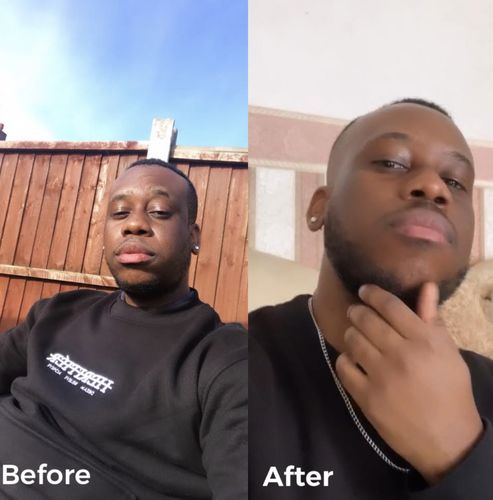 Customer photo review of Inches - Ayurvedic Hair & Beard Growth Oil